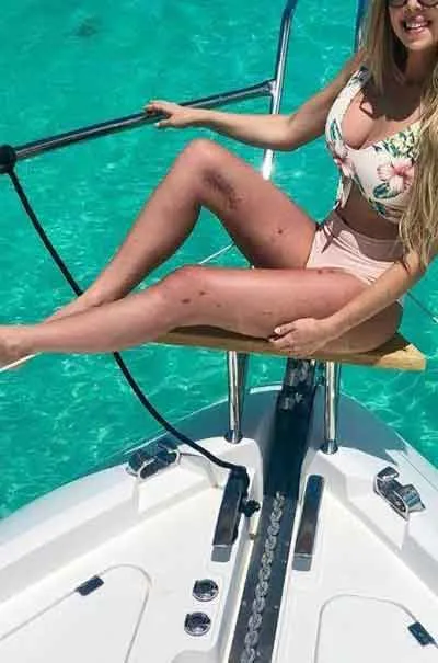 Hanne Løstad